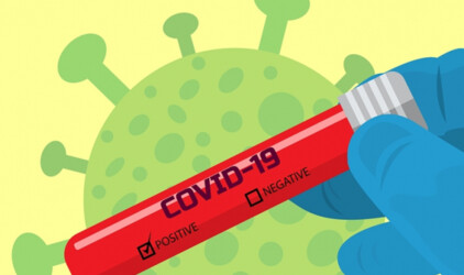 Мэр Екатеринбурга распорядился сократить время исследования тестов на COVID-19